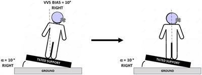 Asymmetry and rehabilitation of the subjective visual vertical in unilateral vestibular hypofunction patients